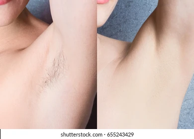 womens-underarm-hair-removal-before-260nw-655243429